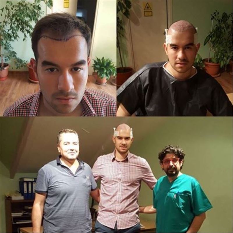 AVRUPA´DAN TRAKYA´YA “SAÇ” TURİZMİ